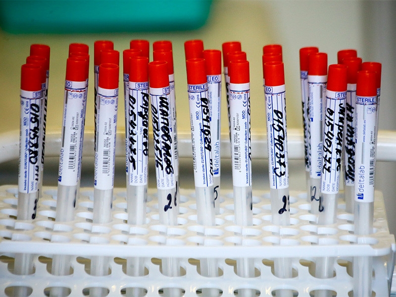 В России  за последние сутки выявлено еще 9 299 случаев COVID-19