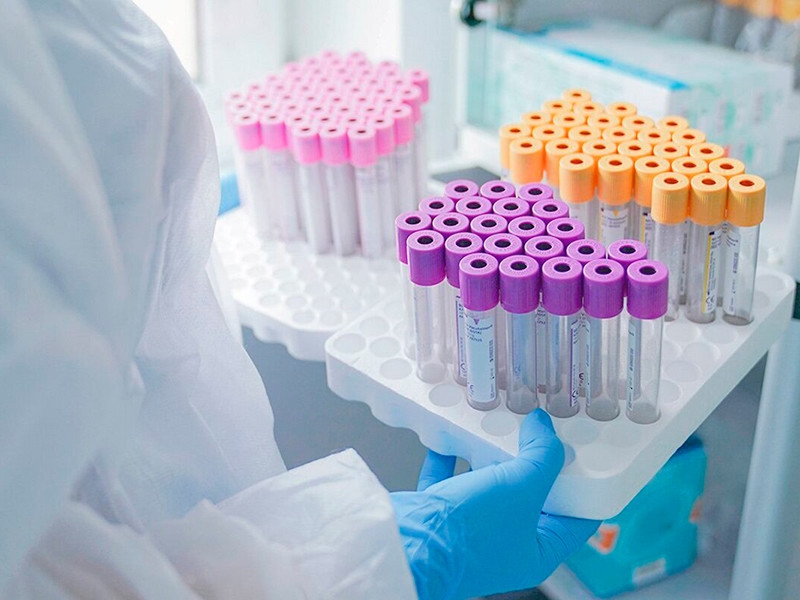 Число новых случаев коронавируса в РФ за сутки составило 7920 - минимум с начала мая