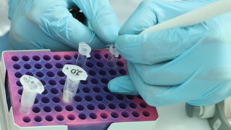 В ФАС заявили об отсутствии нарушений в ценообразовании на ПЦР-тесты