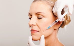 Как уменьшить носогубные складки