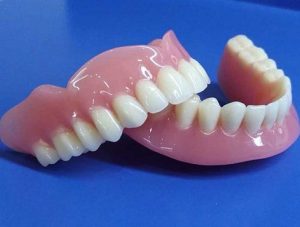 Особенности протезирования зубов. Этапы процесса